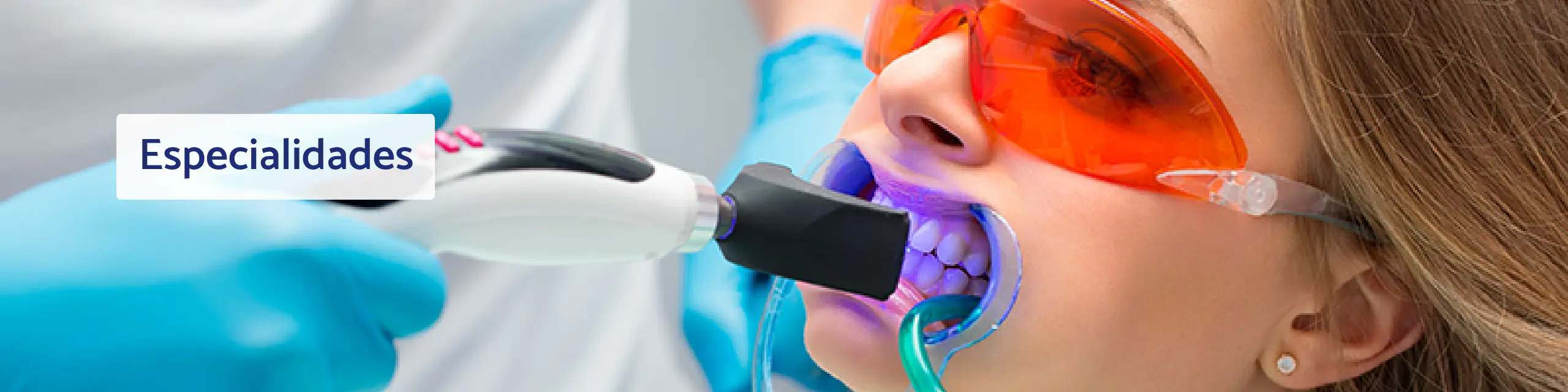 Blanqueamiento Dental