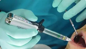 DENTAPEN: La anestesia sin dolor que tus pacientes quieren